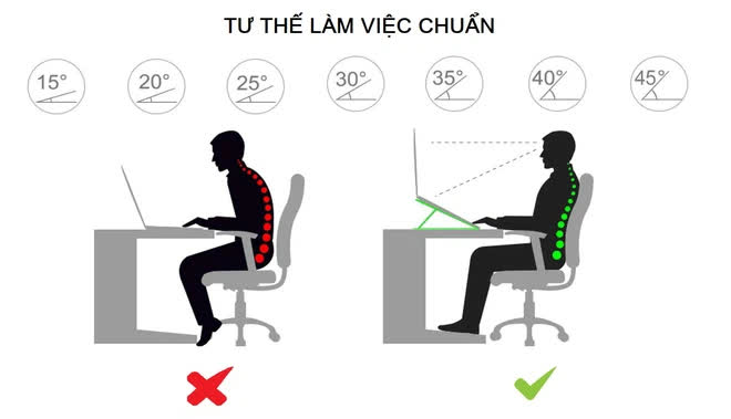 Dùng máy tính xách tay nhiều nên mua ngay một chiếc giá đỡ laptop, cột sống sẽ biết ơn bạn lắm đấy - Ảnh 1.