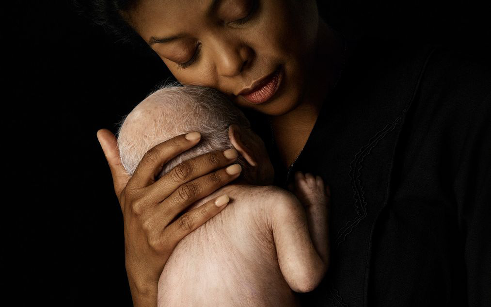 Adalia Rose: Benjamin Button ngoài đời thực, người đã truyền cảm hứng cho hàng triệu người và cái chết ở tuổi 15