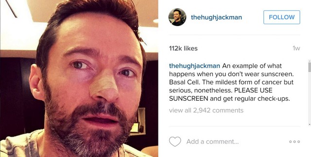 Đến ‘người sói’ Hugh Jackman cũng bị ung thư da, kêu gọi fan dùng kem chống nắng, bạn cũng nên học theo - Ảnh 1.