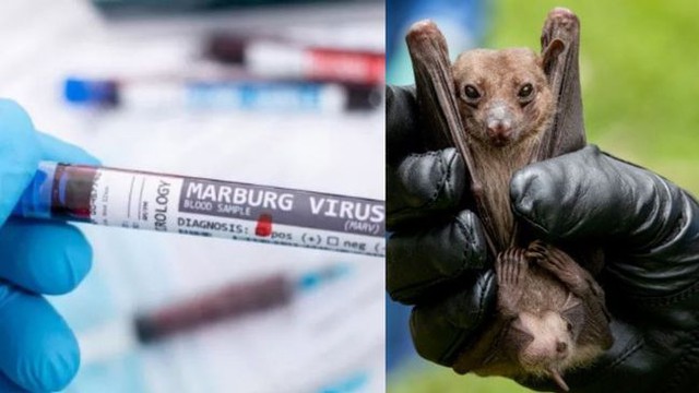 Bùng phát virus Marburg: Một chủng sốt xuất huyết kịch độc, người nhiễm &quot;trông giống như thây ma&quot; - Ảnh 6.