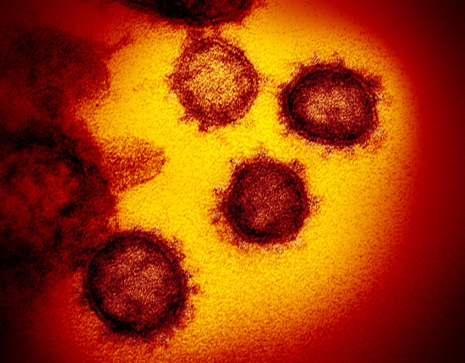 Nhà khoa học Mỹ muốn tự tổng hợp virus Covid-19 bằng cách mua gen online, sau đó ghép lại như xếp hình - Ảnh 4.
