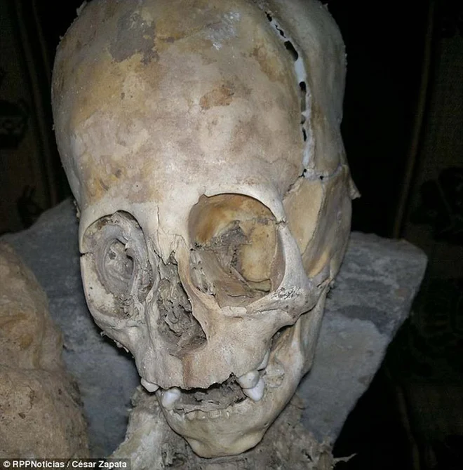 Những hộp sọ kỳ lạ nhất từng được phát hiện trong lịch sử - Ảnh 10.