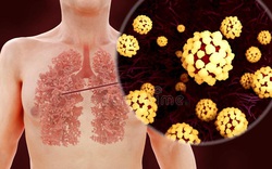 [Infographic] Đây là cách virus Covid-19 tàn phá cơ thể người